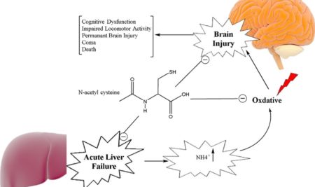 Brain Protection: N-Acetyl Cysteine (NAC)